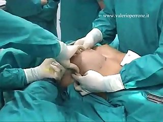  breast augmentation transaxillary prima e dopo mastoplastica additiva per via ascellare youtube